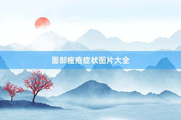 面部痤疮症状图片大全